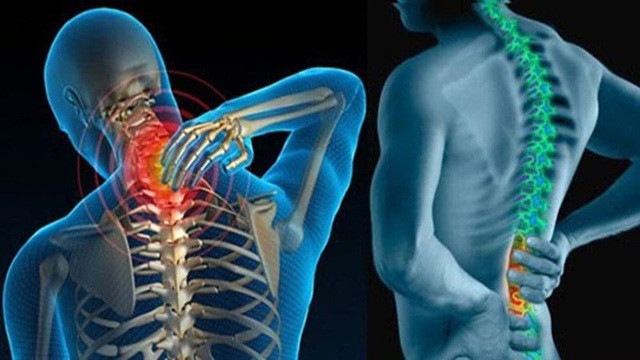 Chuyên gia BV Việt Đức chia sẻ 7 bí quyết bỏ túi để bảo vệ cột sống - Ảnh 2. Chuyên gia BV Việt Đức chia sẻ 7 bí quyết bỏ túi để bảo vệ cột sống - Ảnh 2.