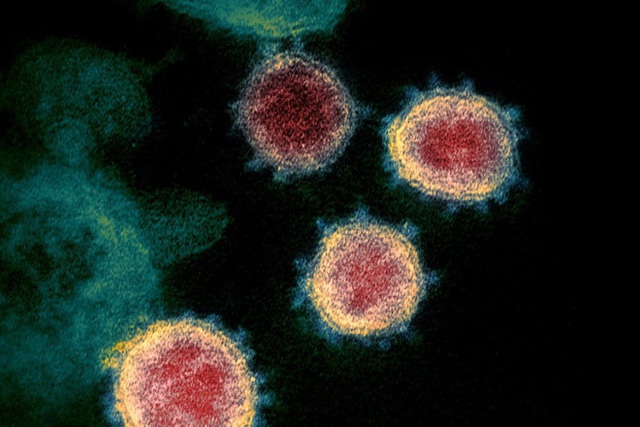  Các nhà khoa học Mỹ đang nghiên cứu siêu vaccine chống chọi được cả họ hàng nhà virus corona? - Ảnh 1.