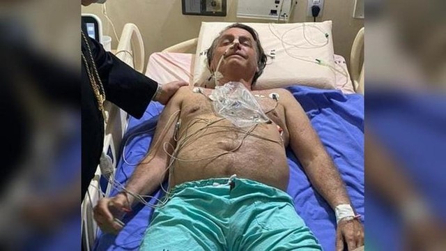 Bị nấc suốt 10 ngày, Tổng thống Brazil được xem xét phẫu thuật khẩn cấp - Ảnh 3.