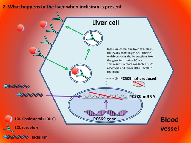 Một mũi tiêm RNA có giá hơn 60 triệu, giúp hạ mỡ máu, phòng ngừa đột quỵ vừa được cơ quan y tế Anh chấp thuận - Ảnh 1.