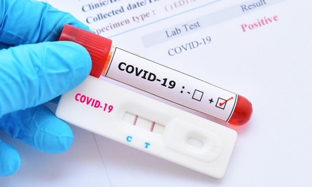 Bộ kit test nhanh COVID-19 giá gốc chỉ 35.000 đồng, trong nước tăng gấp nhiều lần? Thứ trưởng Bộ Y tế chính thức lên tiếng - Ảnh 1.