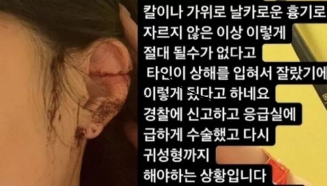 Chấn động Hàn Quốc: Cô gái đi vũ trường qua đêm, hôm sau tỉnh dậy thấy mình bị cắt tai - Ảnh 1.