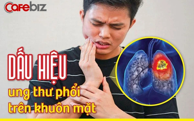 Khi ung thư phát triển ở vùng đỉnh phổi sẽ gây ra triệu chứng sưng trên mặt hoặc cổ; mí mắt bị sụp xuống