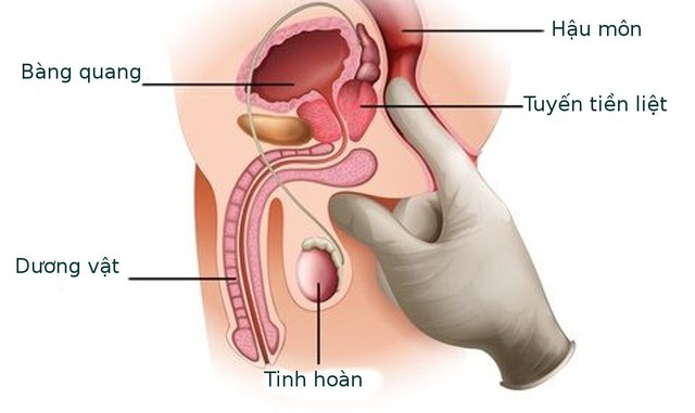 Điểm danh những bệnh ung thư PHỔ BIẾN nhất trên thế giới, chỉ cần LIẾC MẮT qua các điểm này là biết cơ thể có mắc hay không - Ảnh 2.