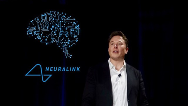 Elon Musk nói sẽ cấy chip vào não người trong năm nay, đây là những gì chúng ta biết về dự án đó - Ảnh 11.