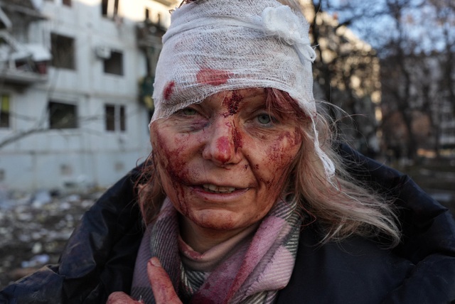  Sự thật bức ảnh biểu tượng người phụ nữ Ukraine thương nặng sau cuộc không kích của Nga - Ảnh 1.