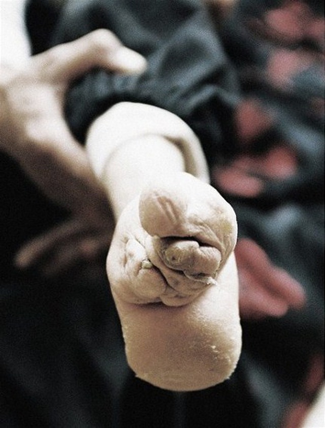 Hình ảnh của những đôi chân gót sen cuối cùng tại Trung Quốc: Nhân chứng sống ám ảnh về hủ tục đau thương bậc nhất thời phong kiến - Ảnh 12.