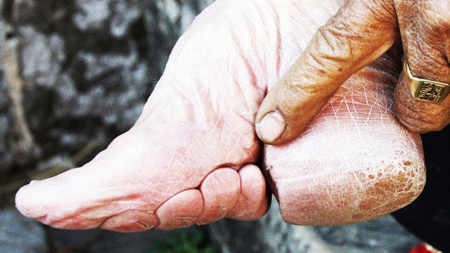 Hình ảnh của những đôi chân gót sen cuối cùng tại Trung Quốc: Nhân chứng sống ám ảnh về hủ tục đau thương bậc nhất thời phong kiến - Ảnh 13.