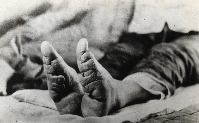 Hình ảnh của những đôi chân gót sen cuối cùng tại Trung Quốc: Nhân chứng sống ám ảnh về hủ tục đau thương bậc nhất thời phong kiến - Ảnh 14.