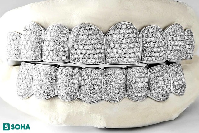   From satisfying personal needs, the guy creates diamond jewelry for his teeth, selling 400 million/set - Photo 13.