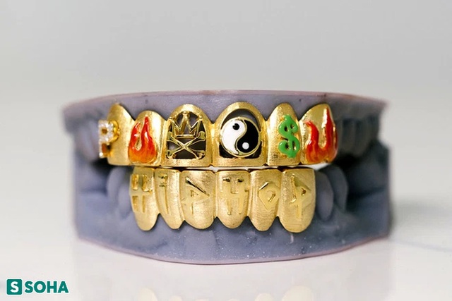   From satisfying personal needs, the guy creates diamond jewelry for his teeth, selling 400 million/set - Photo 15.