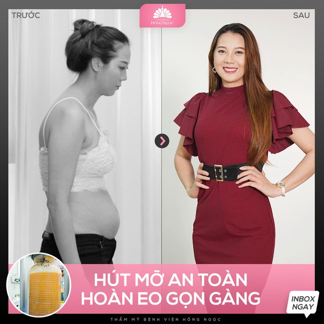 Quyết tâm giảm 20kg, người phụ nữ thay đổi vóc dáng ngoạn mục sau khi bị chồng bỏ vì tăng cân sau sinh - Ảnh 1.