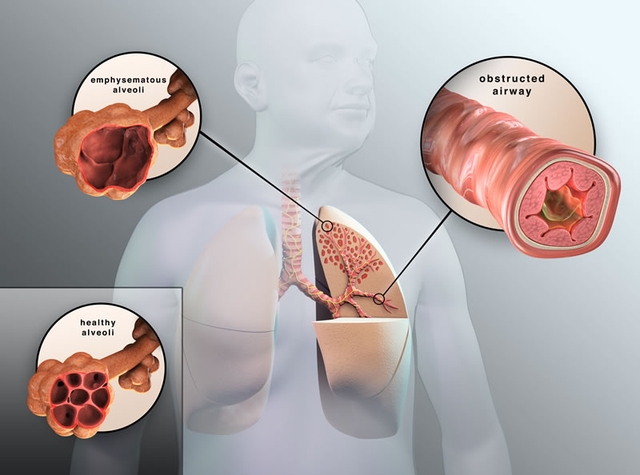 Phần mới của cơ thể được tìm thấy ẩn trong phổi - Ảnh 3.