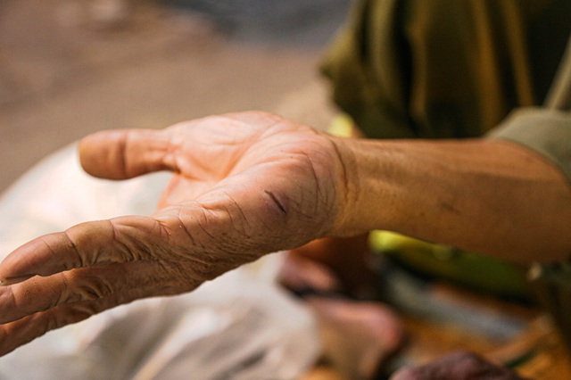   The 67-year-old disabled man left his hometown to go to the streets to collect garbage for a living, afraid of burdening his children and grandchildren - Photo 6.