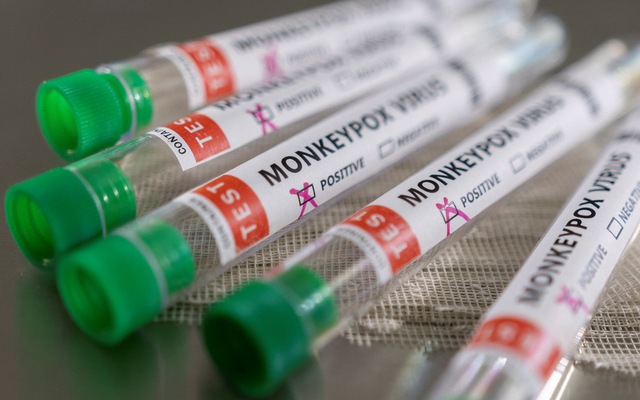 Mỹ chi 119 triệu USD để mua vắc xin đậu mùa khỉ