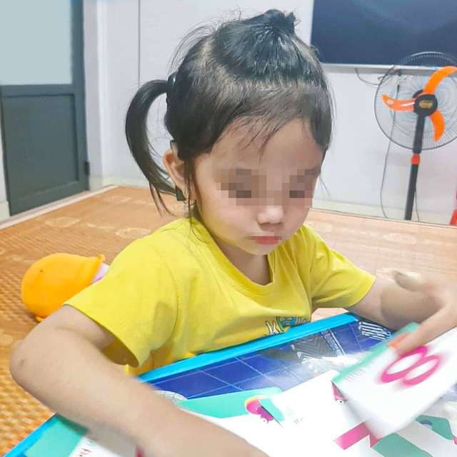 A baby girl who is born deaf, hears her mother's call for the first time after 17 months of living in silence: If the child is not startled by loud sounds, parents should not be subjective - Photo 1.