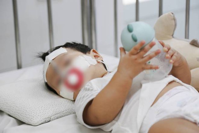 TP.HCM nắng nóng mưa nhiều, bác sĩ Nhi đồng cảnh báo bệnh viêm phổi gia tăng khiến nhiều trẻ phải thở máy, suy hô hấp - Ảnh 16.