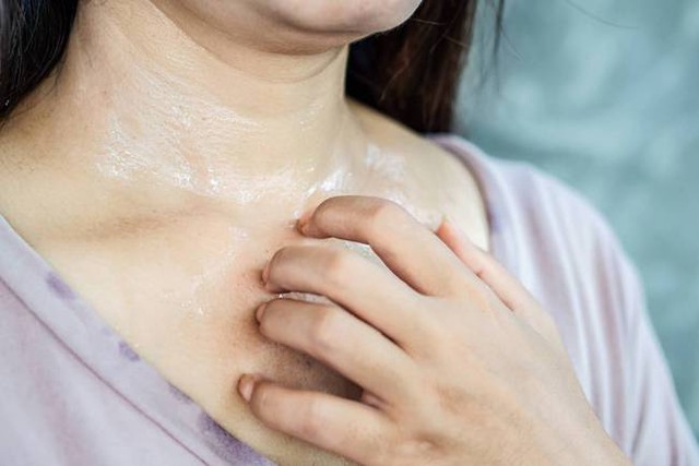 Đổ mồ hôi kèm dấu hiệu này, bạn cần đi khám ung thư khẩn cấp - Ảnh 2. Đổ mồ hôi kèm dấu hiệu này, bạn cần đi khám ung thư khẩn cấp - Ảnh 2.