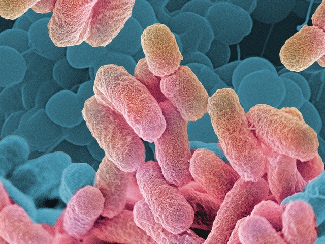 
Ngày càng có nhiều chủng vi khuẩn đa kháng thuốc thậm chí là kháng tất cả kháng sinh xuất hiện
