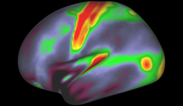 Một hình ảnh khác cung cấp thông tin về các vị trí giàu myelin (đỏ, vàng) hay ít myelin (xanh, tím)