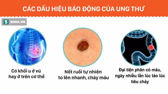 Ai cũng có thể bị ung thư, giáo sư đầu ngành Việt Nam chỉ 9 dấu hiệu cần cực kỳ cảnh giác - Ảnh 2.