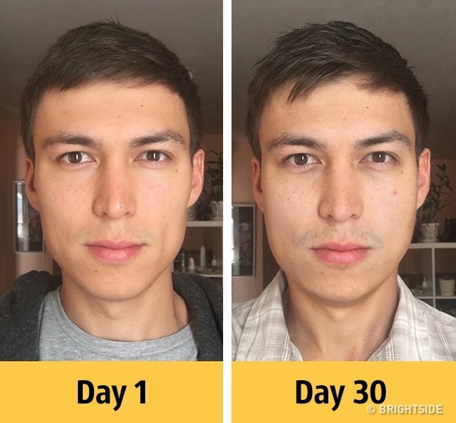  Khuôn mặt thay đổi sau 1 tháng sử dụng bia liên tục. 