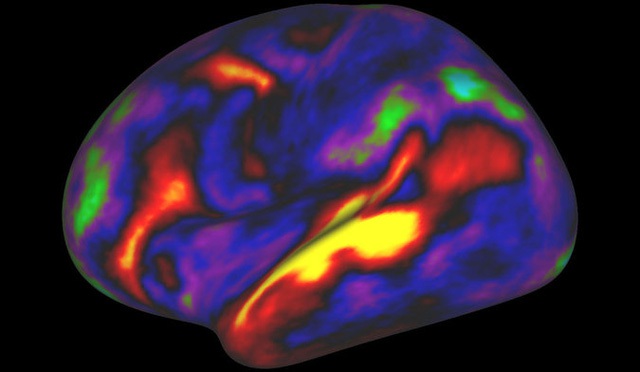 
Ảnh chụp não bộ cho thấy các vùng đang hoạt động (màu đỏ) khi người tham gia nghiên cứu được nghe đọc truyện
