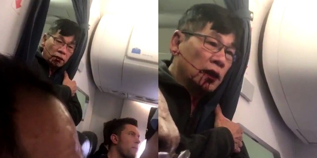 
Hành khách của hãng hàng không United Airlines bị kéo xuống thô bạo với những vết thương trên cơ thể.
