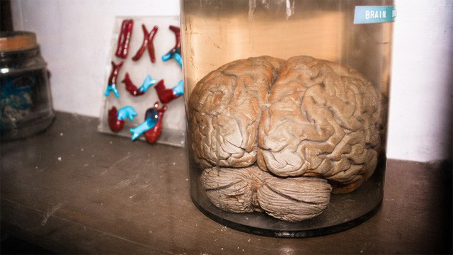 Các nhà khoa học nuôi được não nhân tạo 6 tháng tuổi, lần đầu tiên phát ra sóng não giống trẻ sơ sinh - Ảnh 2.