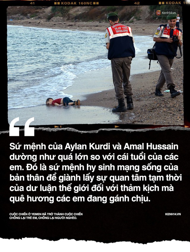 Amal Hussain: Biểu tượng nạn đói Yemen và sứ mệnh hy sinh cho cả dân tộc trên vai những đứa trẻ - Ảnh 4.