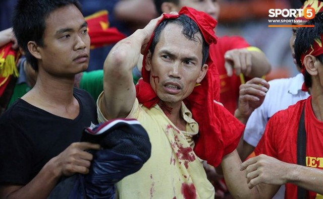 Đêm kinh hoàng: CĐV Malaysia đánh CĐV Việt Nam đổ máu ở AFF Cup 2014 - Ảnh 7.