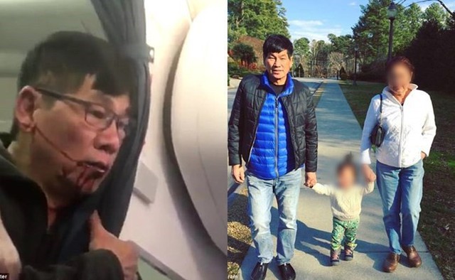 Vụ bác sĩ gốc Việt bị kéo lê thô bạo khỏi máy bay United Airlines: Nhân viên an ninh bị đuổi việc kiện lại hãng hàng không - Ảnh 2.