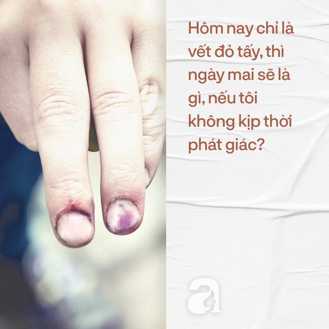 Cô cũng đã có con, nếu con cô đi học cũng bị cô giáo trừng phạt như vậy, cô sẽ cảm thấy thế nào? - Ảnh 2. Cô cũng đã có con, nếu con cô đi học cũng bị cô giáo trừng phạt như vậy, cô sẽ cảm thấy thế nào? - Ảnh 2.