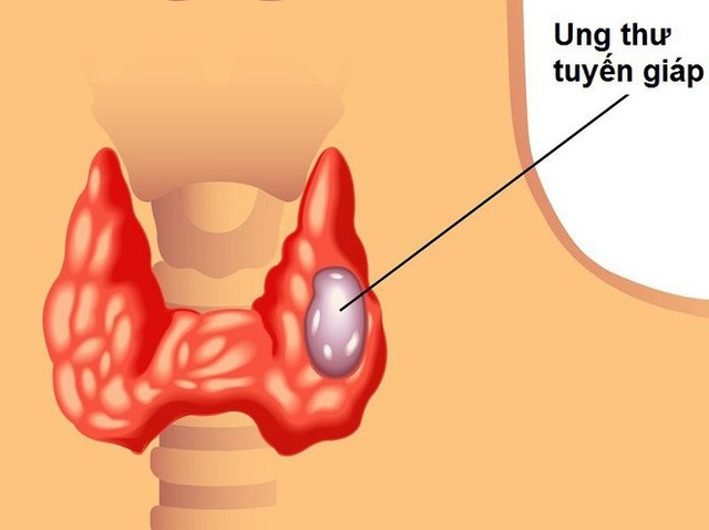 Cảnh báo: Mỗi lần tức giận là 1 trận động đất trong cơ thể, gây ra 20 căn bệnh đáng sợ - Ảnh 4.