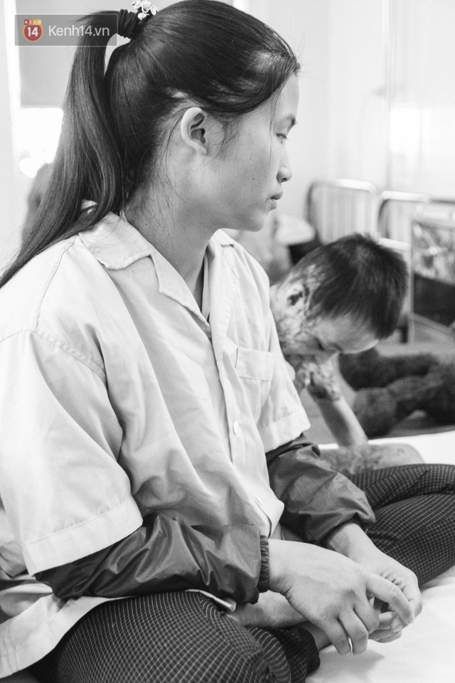 Xót xa những vết bỏng đau đớn trên người bé trai 6 tuổi: Ngày con phải cưa chân là ngày bạn bè vào lớp 1 - Ảnh 2. Xót xa những vết bỏng đau đớn trên người bé trai 6 tuổi: Ngày con phải cưa chân là ngày bạn bè vào lớp 1 - Ảnh 2.