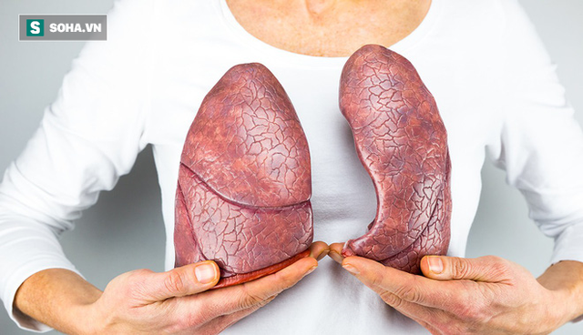 4 việc quan trọng phải làm để ngăn ung thư phổi: Tiếc rằng nhiều người biết quá muộn - Ảnh 1.
