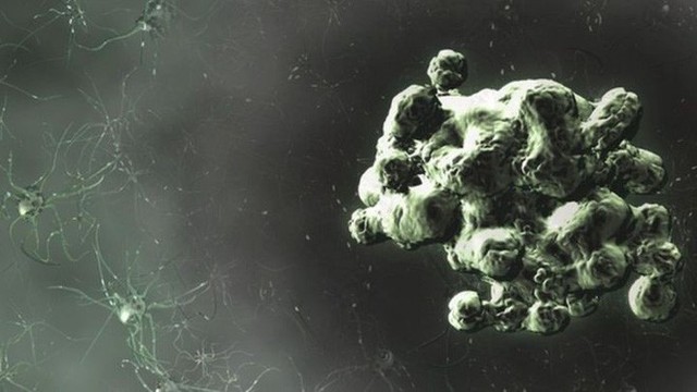 Nguy hiểm hơn Ebola, những người nhiễm bệnh sẽ cười điên loạn như Joker rồi chết - Ảnh 10. Nguy hiểm hơn Ebola, những người nhiễm bệnh sẽ cười điên loạn như Joker rồi chết - Ảnh 10.