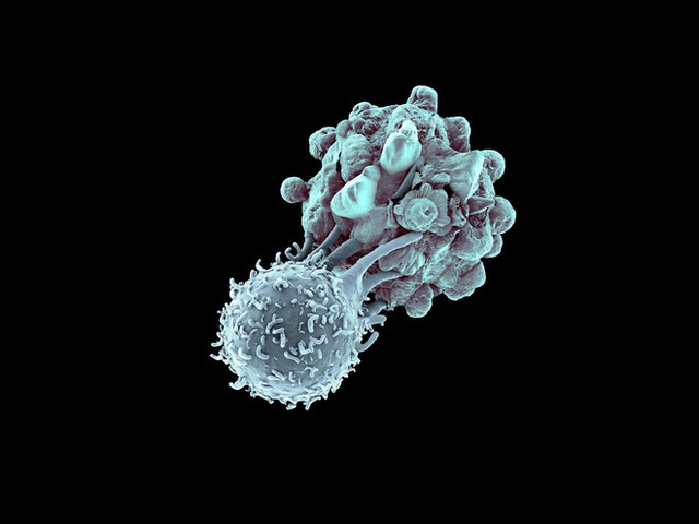 Lần đầu tiên, ba bệnh nhân ung thư ở Mỹ được điều trị bằng kỹ thuật chỉnh sửa gen CRISPR - Ảnh 2.