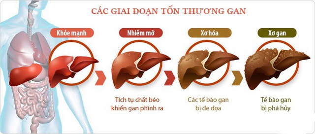 Những lá gan được in 3D sinh học sẽ tạo ra cuộc cách mạng trong lĩnh vực cấy ghép nội tạng - Ảnh 2.