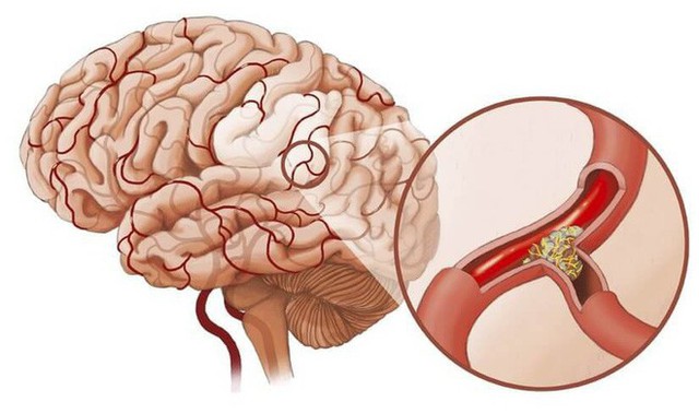  Người đi ngủ sau 12 giờ hàng ngày cơ thể tổn hại ra sao: 4 hậu quả bạn nhất định phải biết - Ảnh 4.