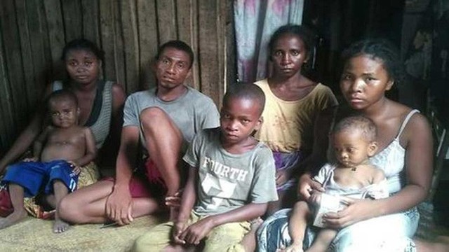 Gần 1.000 trẻ em ở Madagascar chết vì bệnh sởi, người dân không có đủ vắc-xin để tiêm - Ảnh 4.