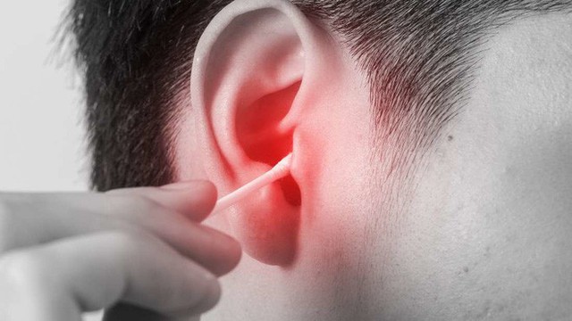 Người đàn ông bị nhiễm trùng não suốt 5 năm chỉ vì sơ suất từ cách vệ sinh tai ai cũng làm này - Ảnh 3.