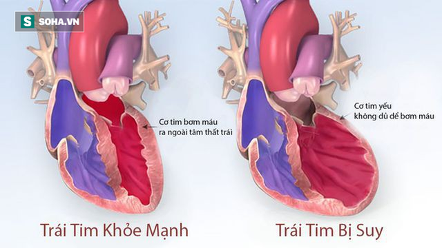  4 dấu hiệu cảnh báo tim của bạn đã gặp nguy hiểm: Hãy nhanh đi khám để tránh rủi ro - Ảnh 1.