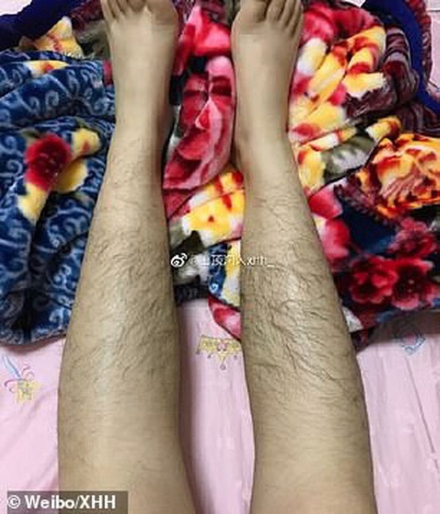 Các thiếu nữ Trung Quốc thi nhau khoe lông tay, lông chân dày đến mức muỗi cũng không đốt nổi - Ảnh 5.