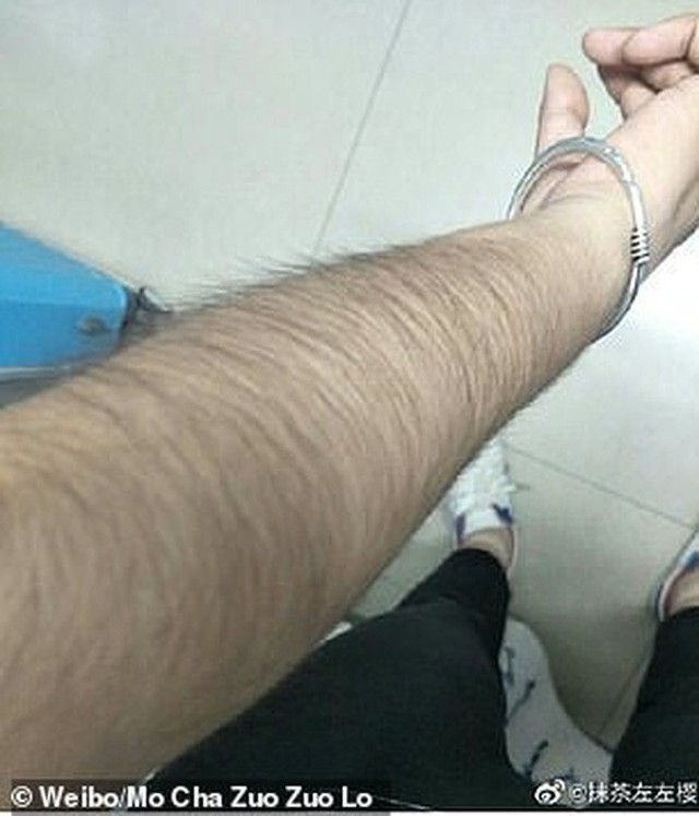 Các thiếu nữ Trung Quốc thi nhau khoe lông tay, lông chân dày đến mức muỗi cũng không đốt nổi - Ảnh 6.
