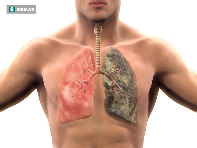  Kiên trì làm 5 việc có thể cải thiện toàn diện sức khỏe của phổi: Mỗi người đều nên làm - Ảnh 1.