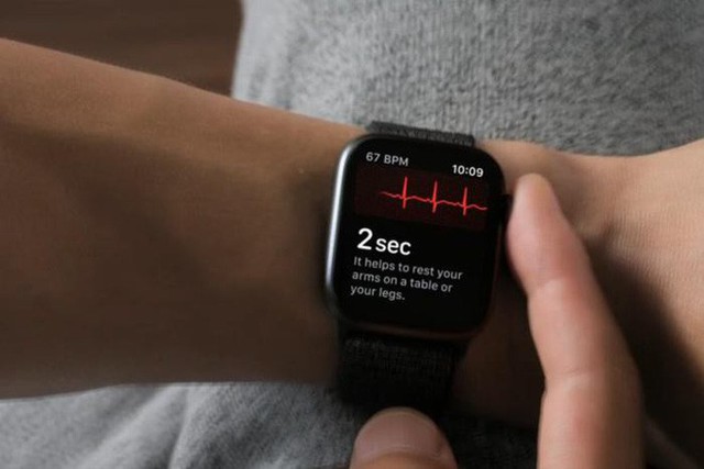 Bác sĩ người Anh cho rằng quá tin vào điện tâm đồ trên Apple Watch có thể gây hại nhiều hơn lợi - Ảnh 1.