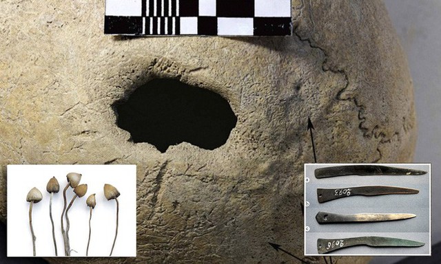 Con người đã thực hiện phẫu thuật sọ trên gia súc từ 5000 năm trước? - Ảnh 2.