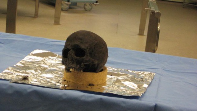 Bí ẩn mảnh não 2.700 năm tuổi, vẫn nguyên vẹn dù cho không hề được tẩm ướp - Ảnh 3.