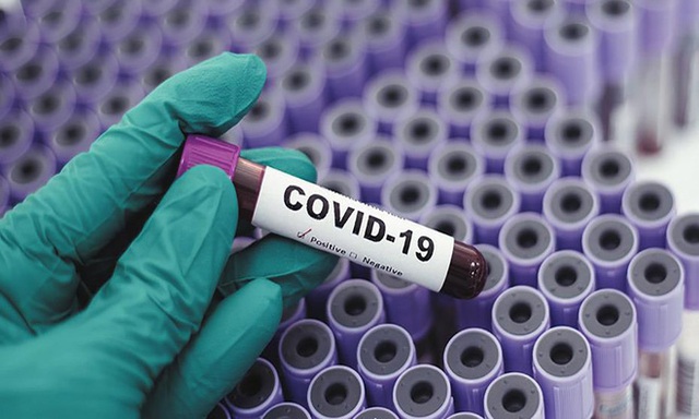 Covid-19 không giống với cúm mùa, nó nguy hiểm gấp hàng chục lần - Ảnh 3.
